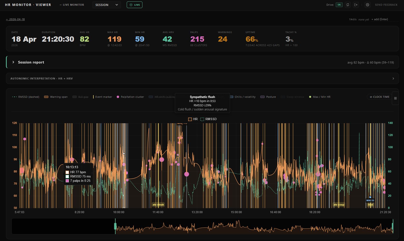 Full session view with HR trace, RMSSD overlay, palpitation clusters, and a sympathetic flush tooltip